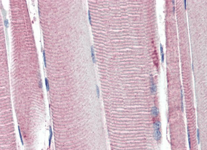 Goat anti-Uncoupling protein 2 / UCP2 Antibody
