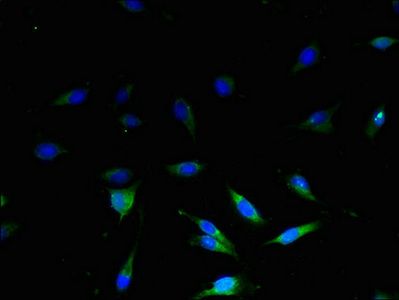 UCP3 Antibody
