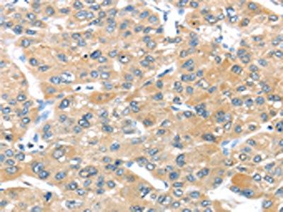 UCP3 Antibody