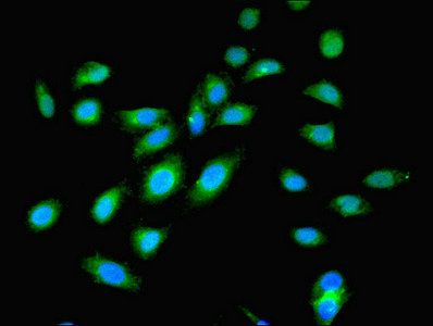 OGT Antibody