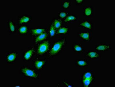 UDP-N-acetylglucosamine-peptide N-acetylglucosaminyltransferase 110 kDa subunit antibody