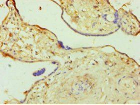 UDP-N-acetylglucosamine-peptide N-acetylglucosaminyltransferase 110 kDa subunit antibody