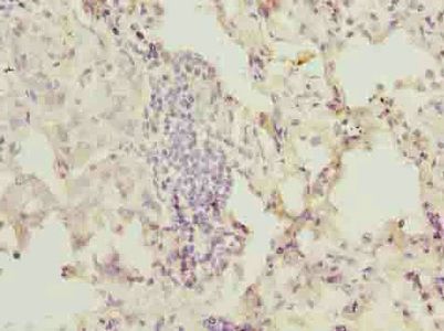 OGT Antibody