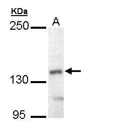 UBE4B antibody [C2C3], C-term