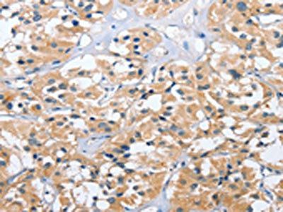 UGCG Antibody