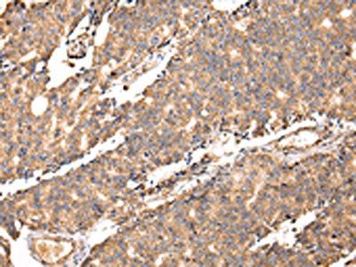 UGGT2 Antibody