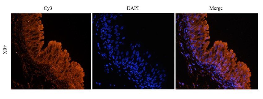 UGT1A1 antibody