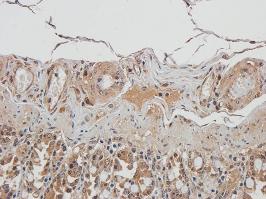 UGT1A1 antibody