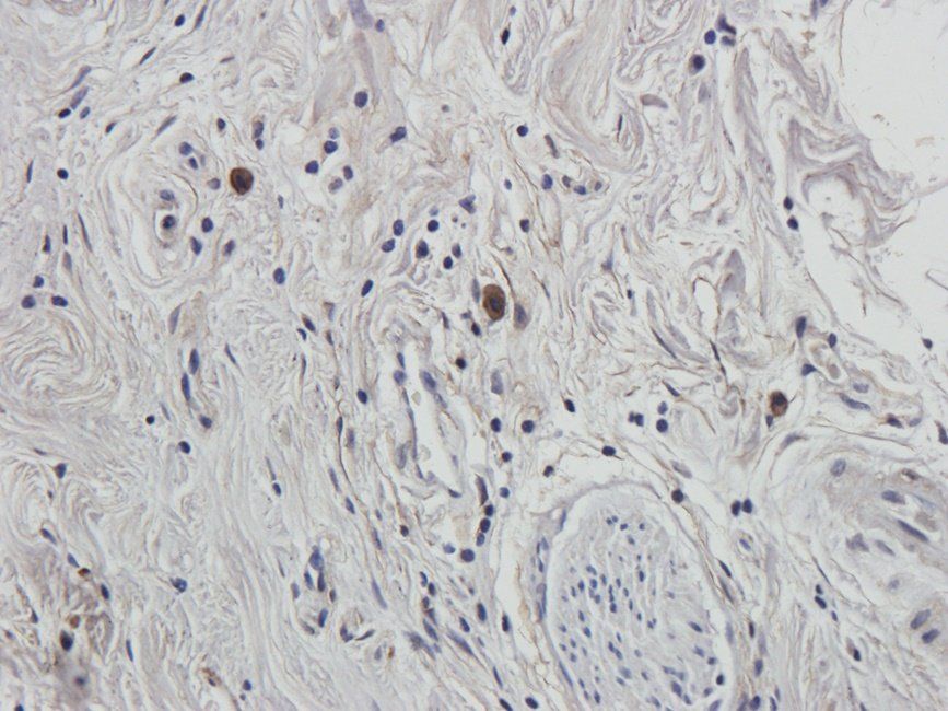 UGT1A1 antibody