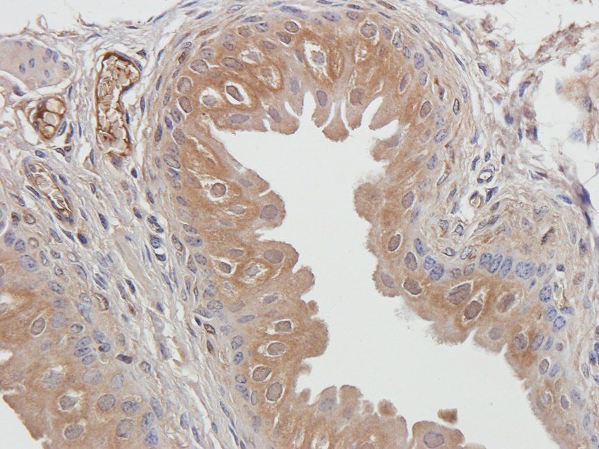 UGT1A1 antibody