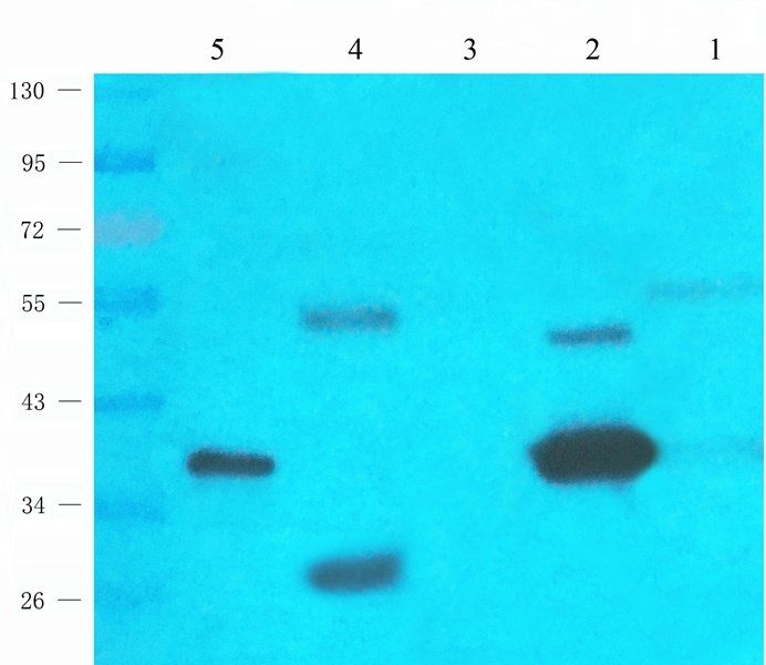 UGT1A1 antibody