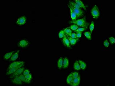 UGT1A1 Antibody