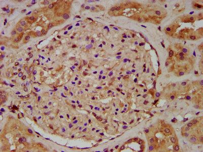 UGT1A6 Antibody
