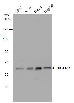 UGT1A6 antibody