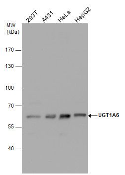 UDP glucuronosyltransferase family 1 member A6 Antibody