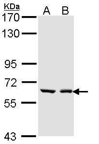 UDP glucuronosyltransferase family 1 member A6 Antibody