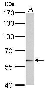 UDP glucuronosyltransferase family 1 member A6 Antibody