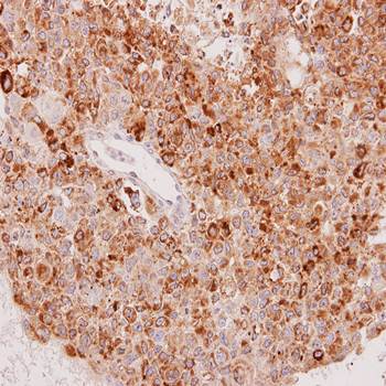 UGT1A6 Rabbit Polyclonal Antibody