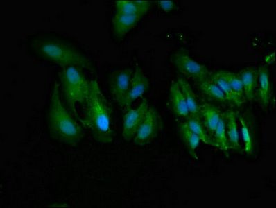 UGT1A9 antibody