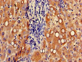 UGT1A9 Antibody