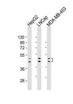 UGT2B4 antibody