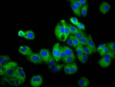 UGT2B7 antibody