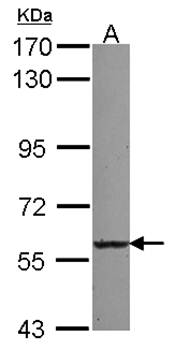 UGT2B7 Rabbit Polyclonal Antibody