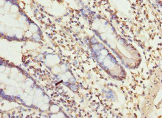 UGT3A2 Antibody