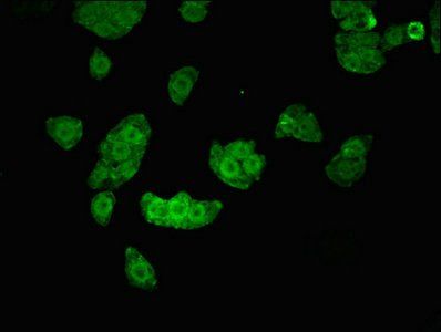UHMK1 Antibody