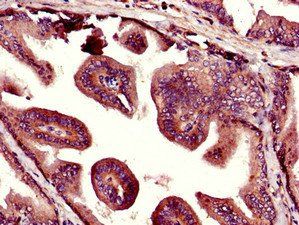 UHMK1 Antibody