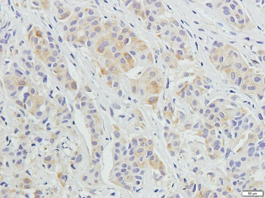 UHRF2 antibody