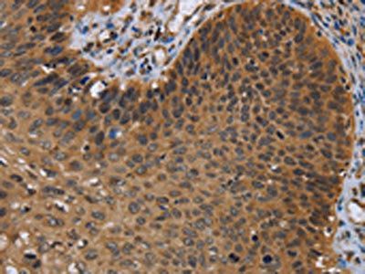 UHRF2 Antibody