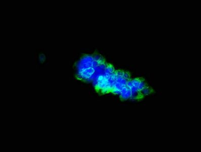 ULBP1 antibody