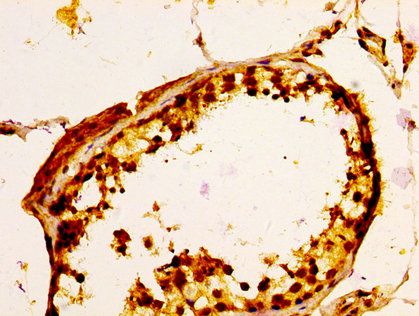ULBP1 Antibody