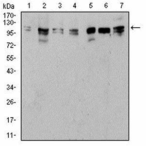 ULK2 Antibody