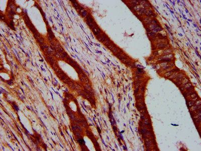 ULK2 Antibody