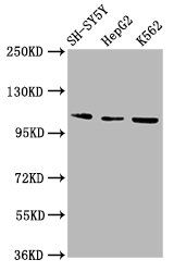 ULK2 antibody