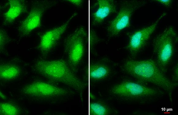 unc-51 like autophagy activating kinase 2 Antibody