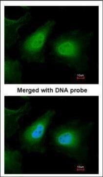 ULK2 antibody [C2C3], C-term