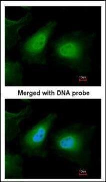 ULK2 antibody