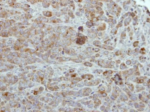 ULK2 antibody