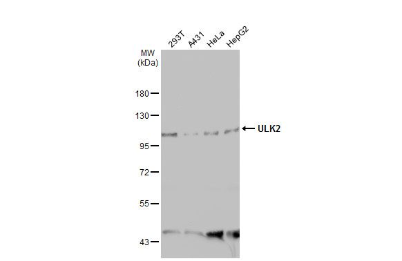 ULK2 antibody [C2C3], C-term