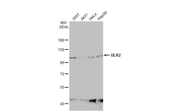 ULK2 antibody