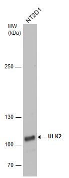 ULK2 antibody [C2C3], C-term