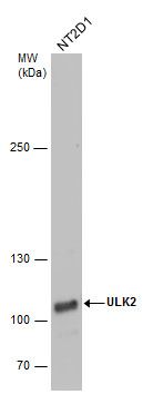 ULK2 antibody