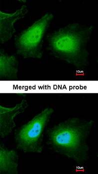 ULK2 antibody