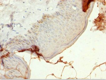 ULK4 Antibody
