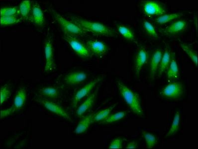 UMPS Antibody