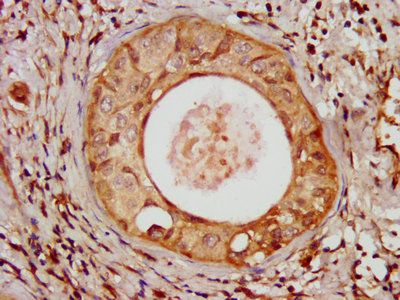UMPS Antibody