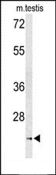 UNC119 antibody